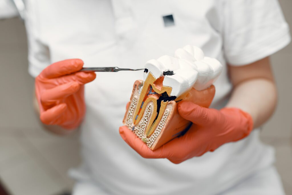 femme portant une maquette représentant une dent carriée - ares dental