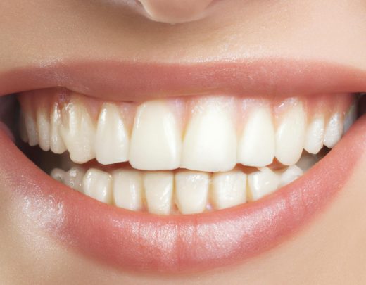 Beau sourire blanc ares dental - pexel