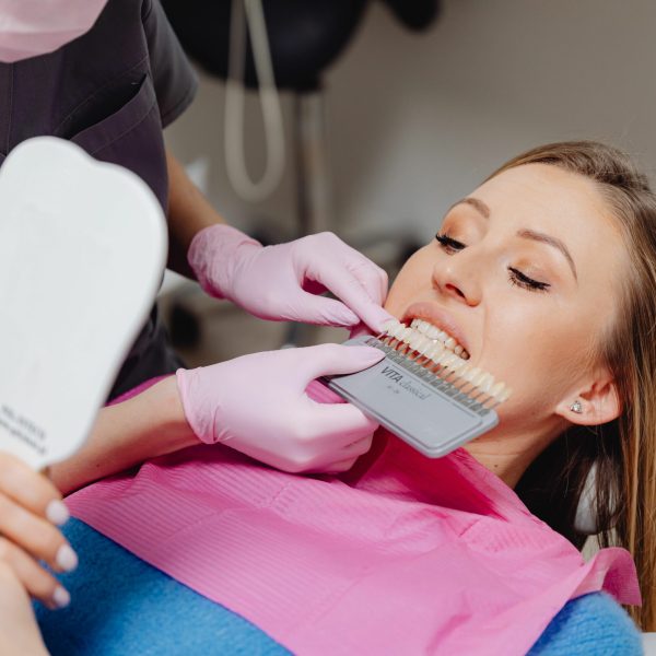 FACETTES DENTAIRES ARES DENTAL 3