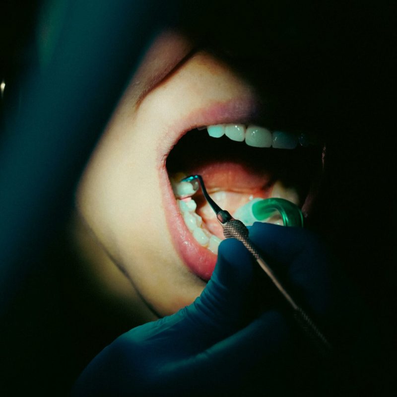 Urgence dentaire 4 ares dental - bouche oscultée