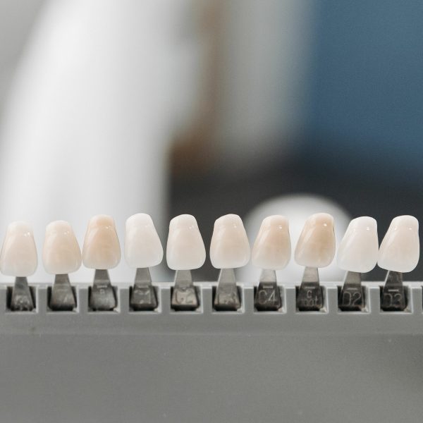 dent facette dentaire ares dental