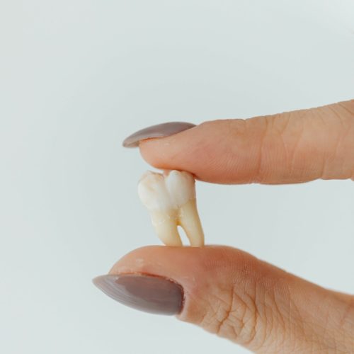 doigts tenant une dent -ares dental