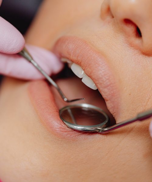femme se faisant osculter la bouche chez le dentiste - ares dental