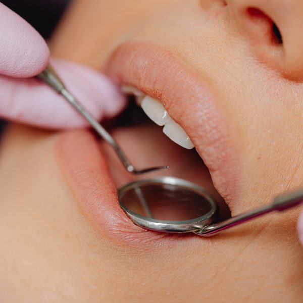 femme se faisant osculter la bouche chez le dentiste - ares dental