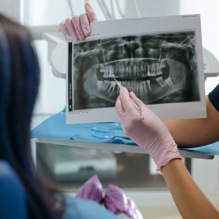 radiograhie dents