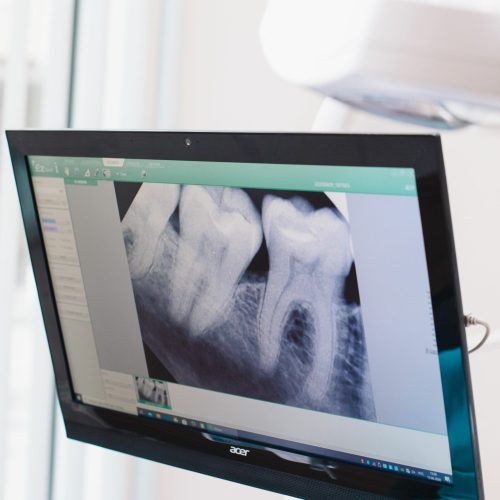 radiographie des dents d'un patient - ares dental