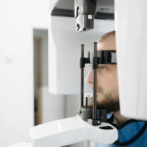scanner 3D CBCT dentiste ares dental - pexels