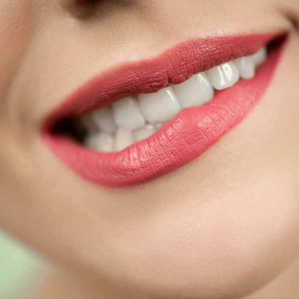 sourire dentaire ares dental-pexel